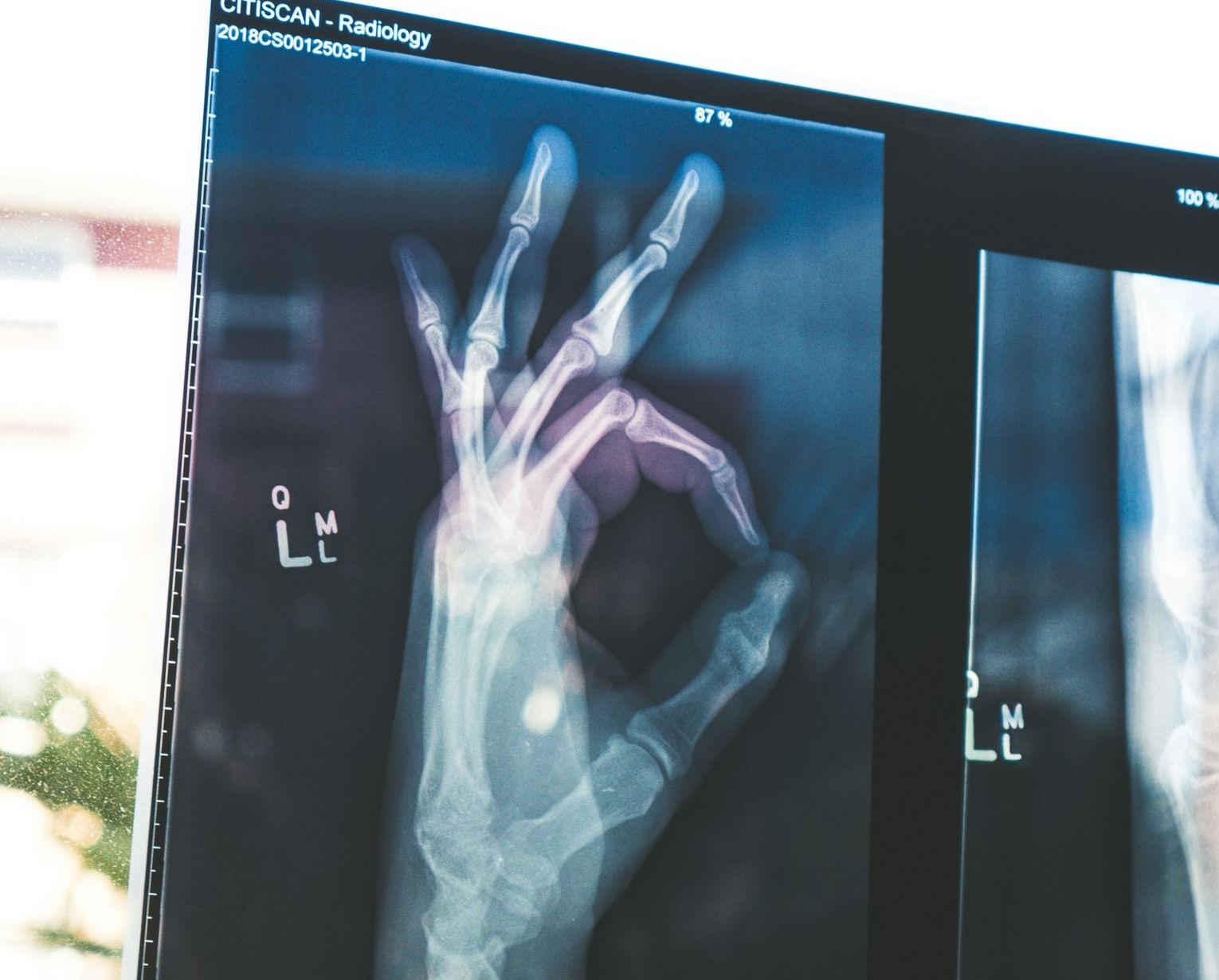 citiscan result hand ok